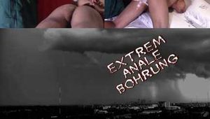 EXTREME ANAL