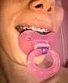 With my orthodontic braces and pacifier